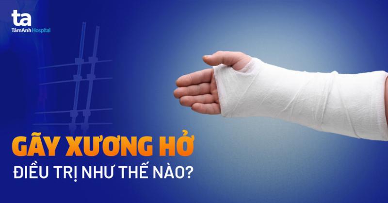 Hinh anh cac manh xuong ga nau chin bi vo vun nguy hiem cho cho